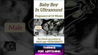 Baby Boy In Ultrasound  An Excellent Clip  shorts [upl. by Westleigh]