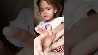 मेरी मझली बेटी के अंगुली का Opration कराना परेगा 😭😭😭 opration hospital minivlog reallity shorts [upl. by Neelloj266]