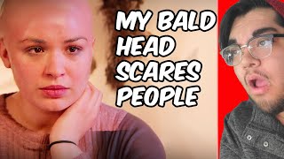 Dumb Girl Gets Dumped For Being Bald [upl. by Benjamen]