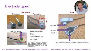 Electroencephalography EEG [upl. by Bergin]