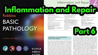 Arachidonic Acid metabolites Robbins pathologyProstaglandins and LeukotrienesInflammatory Mediator [upl. by Ermine]