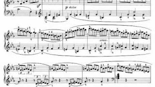 Beethoven Sonata quotPathetiquequot Op 13  III Rondo Allegro [upl. by Hibbs]