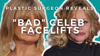 What went wrong with Goldie Hawn and Melanie Griffiths Facelifts [upl. by Inat]