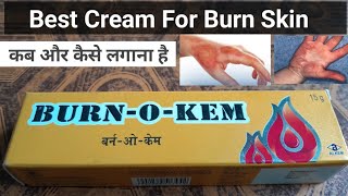 Burn O Kem Cream Antiseptic cream [upl. by Vanzant132]