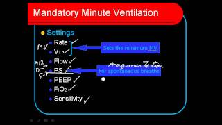 Mandatory Minute Ventilation MMV [upl. by Mikiso]