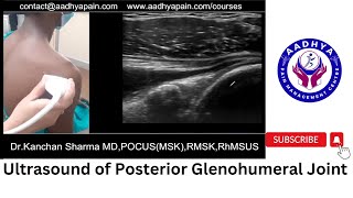 Ultrasound of Posterior Glenohumeral Joint [upl. by Blandina]