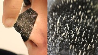 BEST WAY TO MAKE PORE STRIPS WORK BETTER NOT CLICKBAIT [upl. by Ojibbob]