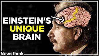 How Einstein’s Unique Brain Made Him Smarter [upl. by Euqinomahs310]