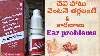 Ear pain chevi noppi treatment in allopathic in Telugu Ear pain Candibiotic drops [upl. by Netti682]