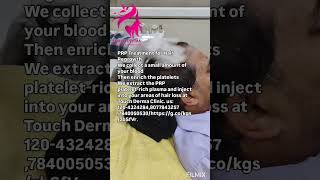 PRP Treatment for Hair RegrowthPRP plateletrich plasma Touch Derma Clinicus80778432577840050530 [upl. by Prasad]