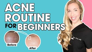 Acne Skincare Routine for Beginners  The Budget Dermatologist [upl. by Inafetse]