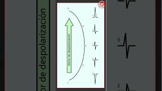 ECG 2  Vector de despolarización [upl. by Ecirum346]