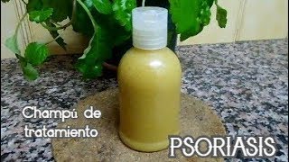 Cómo hacer un CHAMPÚ para la PSORIASIS tratamiento [upl. by Steve]