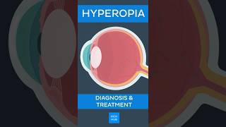 Hyperopia Diagnosis amp treatment  Kenhub hyperopia [upl. by Drehcir685]