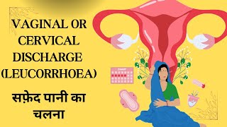 ALL ABOUT CERVICITIS सफ़ेद पानी आने की समस्या [upl. by Missy]