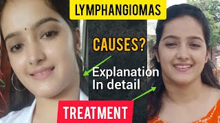 LYMPHANGIOMAexplanation in detailhow I treated it👍 CAUSES TYPES AND SYMPTOMS [upl. by Atteuqal]