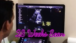 28 weeks pregnant ultrasound  DrProbhodana Ranaweera  Ninwells Hospital  28 weeks [upl. by Barnet90]