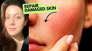 Repair your damaged skin barrier in 1 week  How to treat different types of skin damage correctly [upl. by Emsmus]