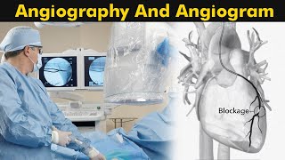 What is Angiography and Angiogram  How Angiography is performed 3D Animation [upl. by Akiemat182]