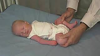 49  Tone Lower Extremity Tone  Newborn Abnormal  Infant Clinical ExaminationMRCP [upl. by Enitsenre]