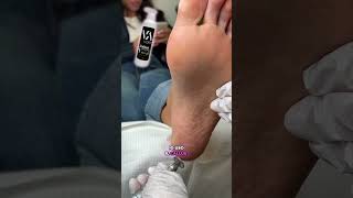 Qual è il miglior callus remover per i tuoi piedi nails angelicaoglobyak manicure [upl. by Akeihsal]