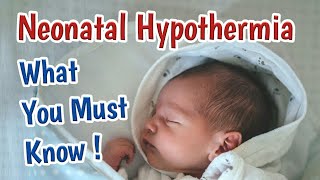 Newborn Hypothermia In Premature amp Term Babies  Newborn Cold Stress [upl. by Enytsuj539]