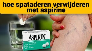 Spataderen verdwenen op de 7e dag neem aspirine en [upl. by Yasu]