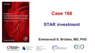 Case 166 Manual of CTO PCI  STAR investment [upl. by Corny439]