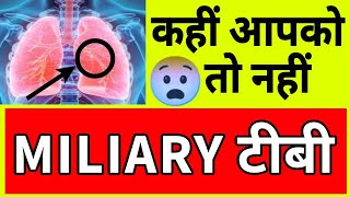 MILIARY TB  मिलिअरी टीबी  कारण लक्षण और उपचार [upl. by Fidela605]