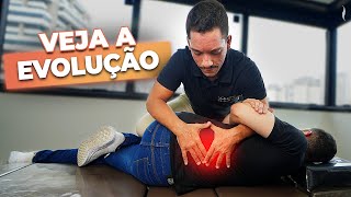 10 ANOS DE DOR LOMBAR VEJA O RESULTADO COM QUIROPRAXIA [upl. by Mariko927]