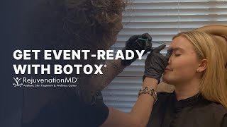 Botox for Lip Flip Forehead Glabella and Masseters [upl. by Aehta134]