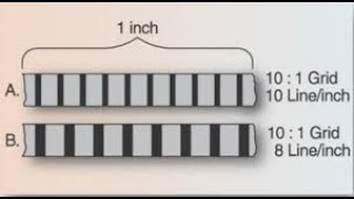 Lecture  Radiographic Grids  Radiographic Physics [upl. by Artenra273]