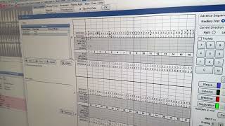 Charting Probing in a Returning Patient in Open Dental [upl. by Vladimar]