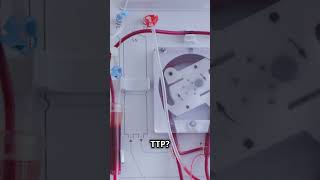 Thrombotic Thrombocytopenic Purpura Explained in 60 Seconds [upl. by Lockhart]