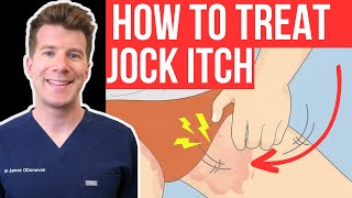 Doctor explains how to RECOGNISE AND TREAT JOCK ITCH aka Tinea Cruris or Ringworm of the groin [upl. by Nylauqcaj349]