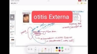 otitis externa amp Malignant otitis externa otorhinolaryngology 2  First Aid USMLE Step 1 [upl. by Oiligriv645]