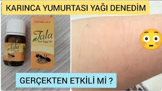 İstenmeyen Tüylerde Deneyin👍Karınca Yumurtası Yağı Nedir❓️ Faydaları 👉Nasıl Kullanılır  Tala [upl. by Nuahs461]