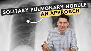 My approach to solitary pulmonary nodules [upl. by Akoek]