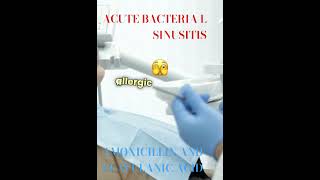 ACUTE BACTERIAL SINUSITIS [upl. by Neerbas]