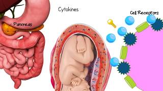 What is Gestational Diabetes Animation [upl. by Cumings]