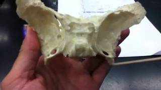 Sphenoid Bone [upl. by Nyladnor]