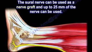 Sural Nerve Anatomy  Everything You Need To Know  Dr Nabil Ebraheim [upl. by Yslehc]