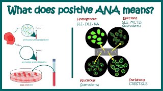 Antinuclear Antibodies ANA test and their patterns  ANA test  What does ANA test positive mean [upl. by Arreic]