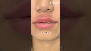 Skinaa Clinic Comprehensive Solutions for All Your Skin amp Hair Needs Skinaa Clinicshorts viral [upl. by Yrakcaz]