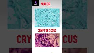 Morphology of some pathogenic fungi pathologyacademy mbbs draditikumar labtechnician [upl. by Binetta287]