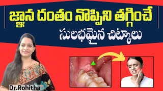 జ్ఞాన దంతం నొప్పికి  Pericoronitis  Causes Symptoms  treatment and Home Remedies in Telugu [upl. by Aldercy]