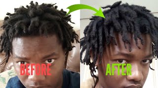 HOW TO GET FREEFORM DREADS PART 4 [upl. by Margot851]