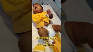 Umbilical Hernia of 21 days Baby ytshorts shorts viralvideo shortvideo trending nicu cute [upl. by Ame953]