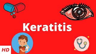 Keratitis Causes Signs and Symptoms Diagnosis and Treatment [upl. by Ativahs652]