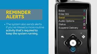 Adjusting Your Alerts –MiniMed 770G System [upl. by Atsirc]